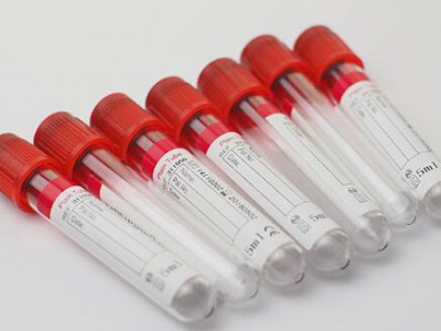 CE and ISO approved sterile medical PET red cap top blood sample collection serum tube
